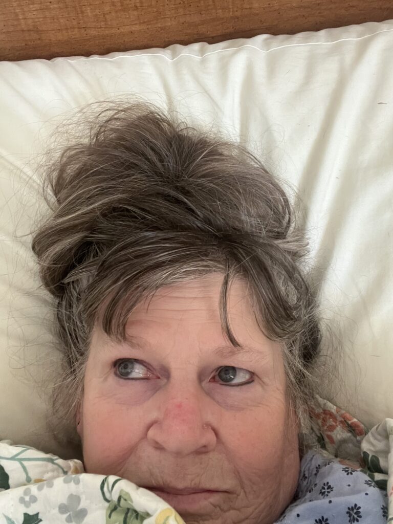 Kelley hiding from a lupus flare. 